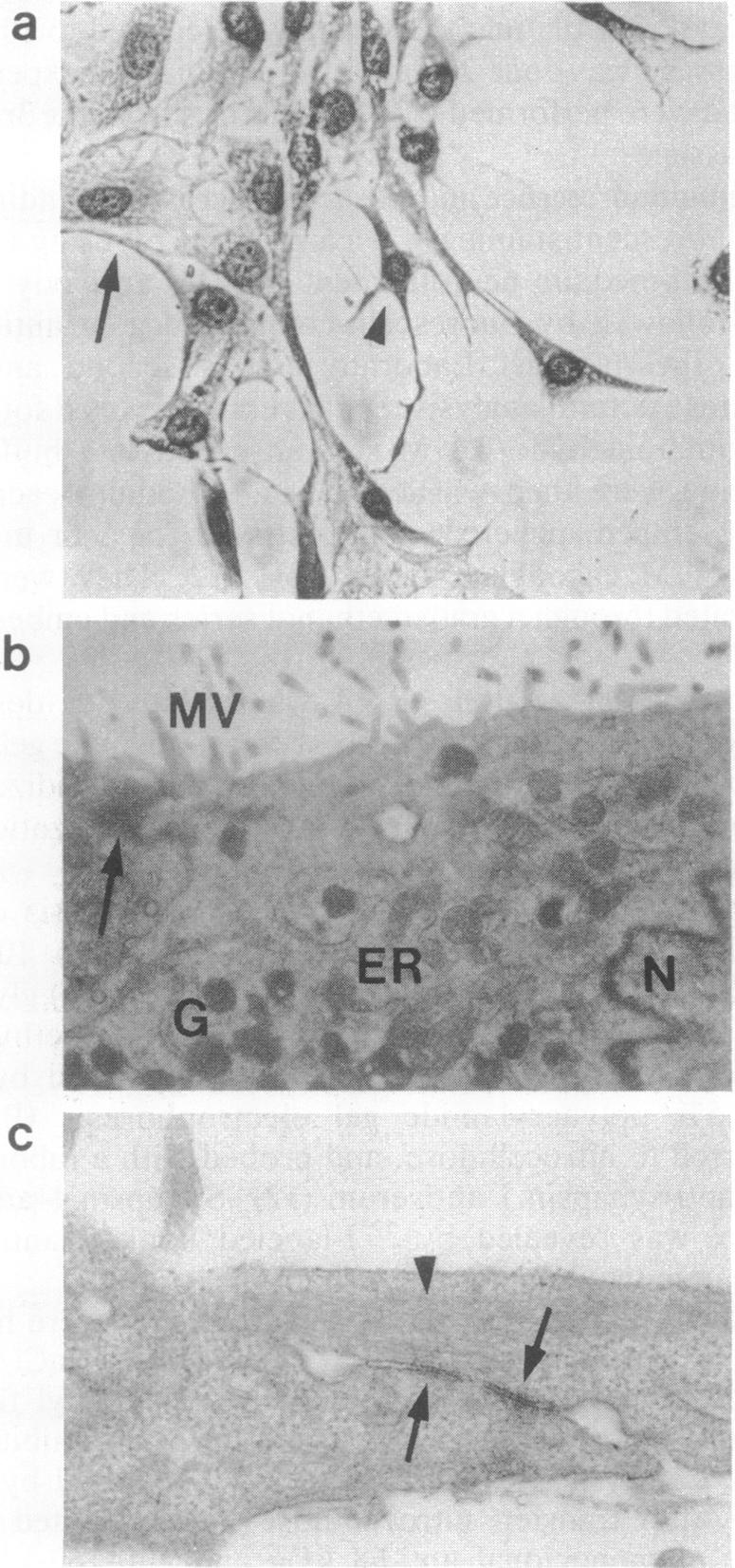 graphic file with name pnas01082-0056-a.jpg