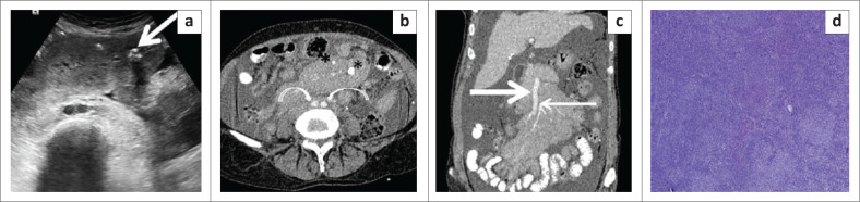 FIGURE 11