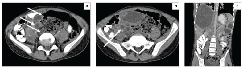 FIGURE 13