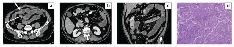 FIGURE 10