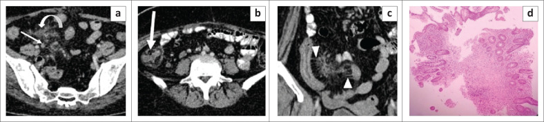 FIGURE 14