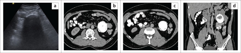 FIGURE 3