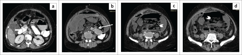 FIGURE 15