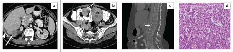 FIGURE 12