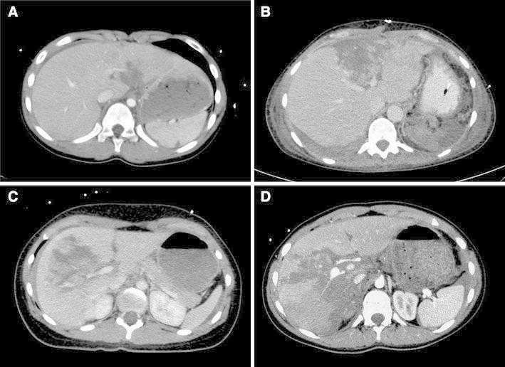 Fig. 2