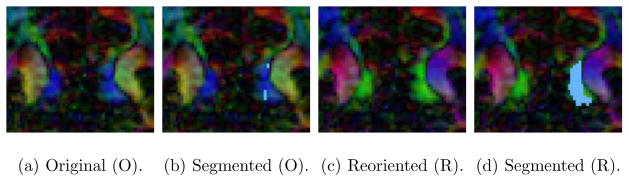 Fig. 11