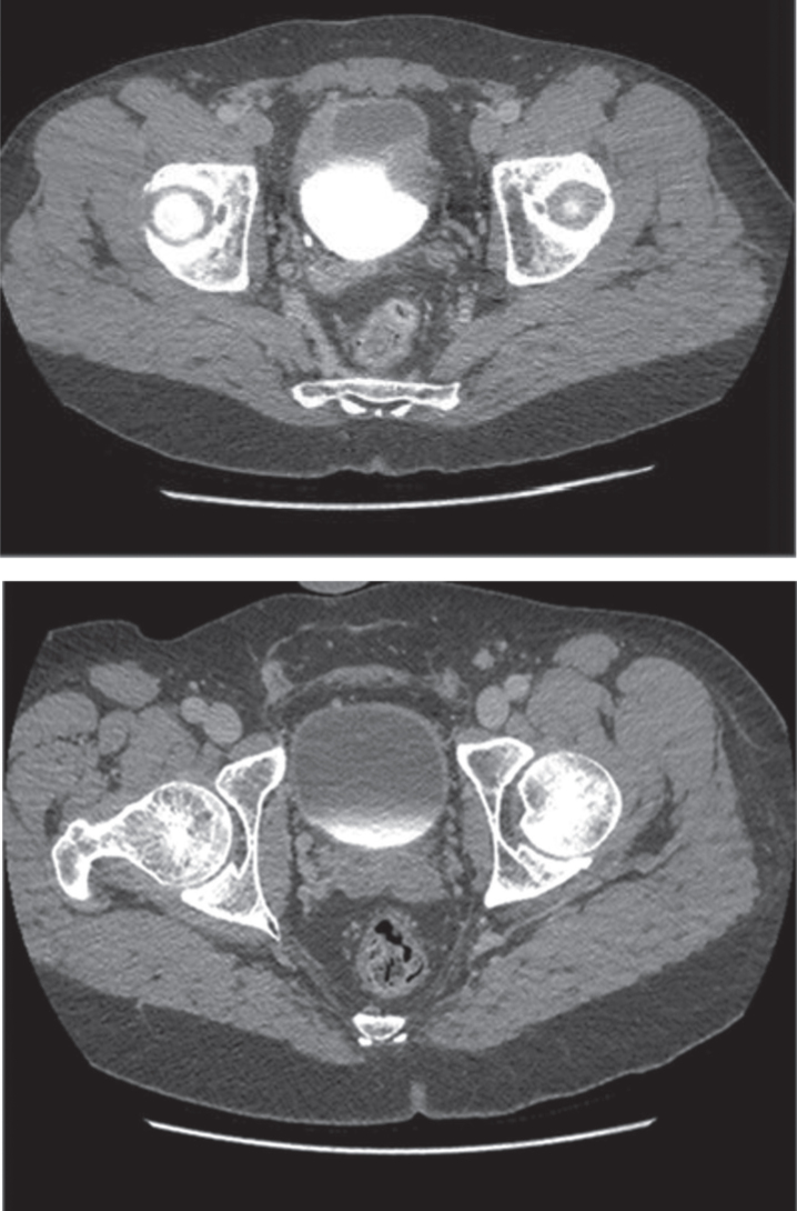 Fig.2