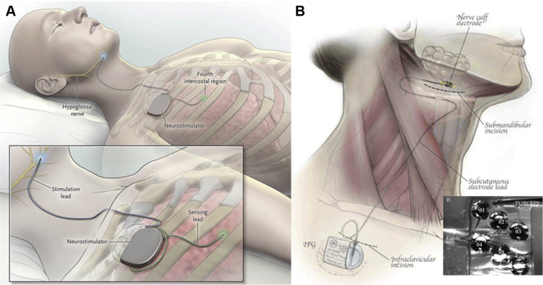 Figure 2