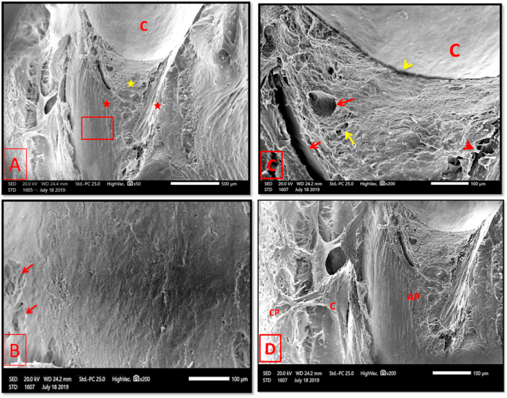 Fig. 11