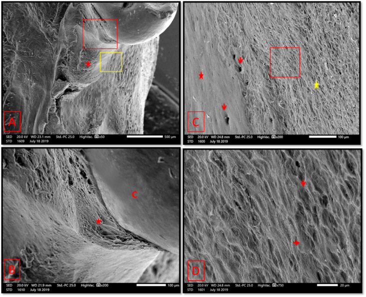 Fig. 12