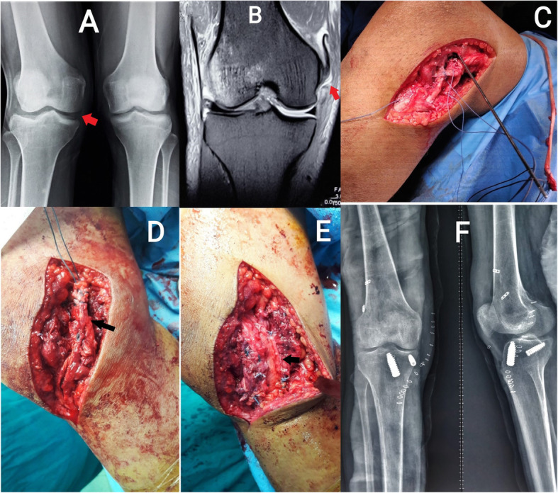 Fig. 6