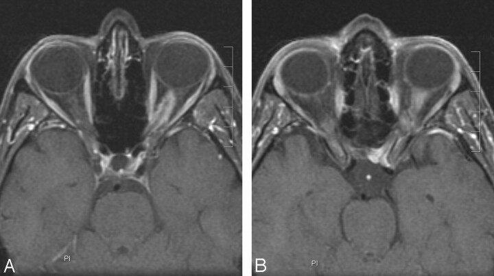 Fig 3.