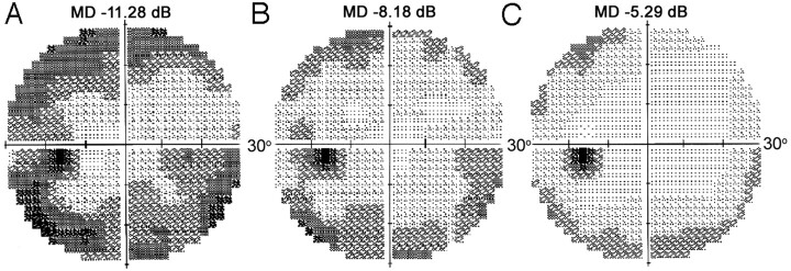 Fig 2.