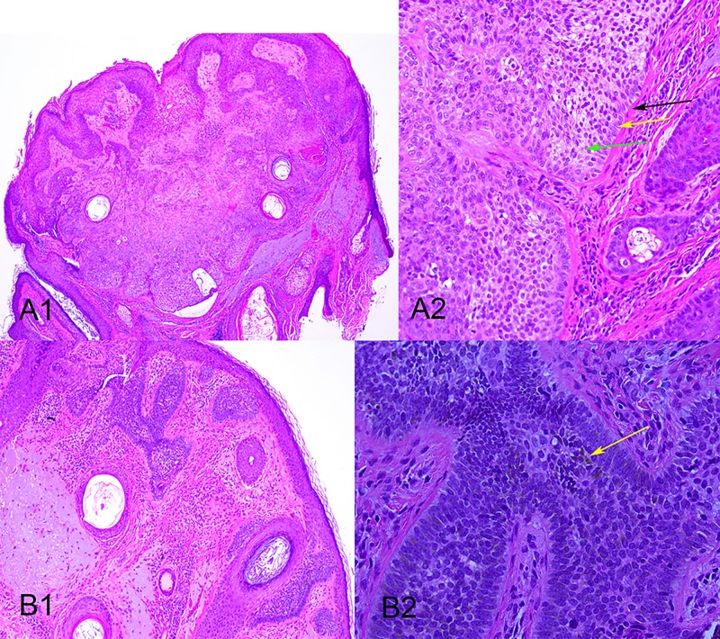 Figure 3A and B.