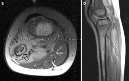 Fig. 12