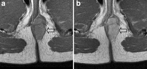 Fig. 6