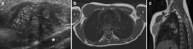 Fig. 14