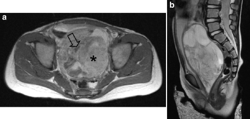 Fig. 11