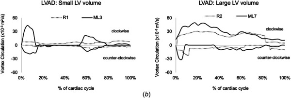 Clinical data [21] (R) and specific ML matching conditions at three cardiac instants (MV, AV, LVAD (pump inlet)). (a) Velocity maps, RT, and shear activation potential maps for the midplane area after 10 cycles of integration. (b) Time-varying vortex circulation (diastole starts at t = 0, second filling phase occurs at 55%, and systole starts at 70% of the cardiac cycle).