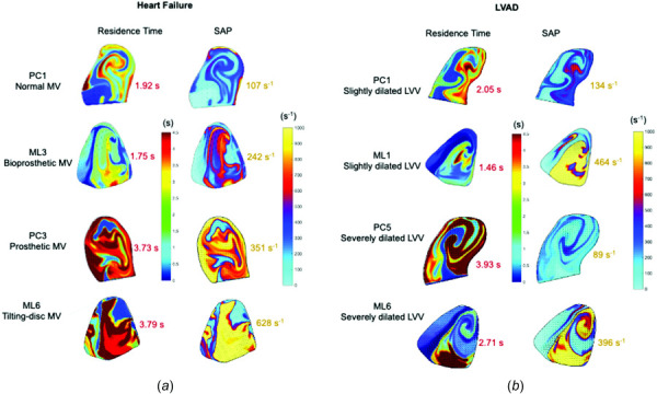 Left ventricle maps of RT and SAP for the midplane area after ten cycles of integration are shown for heart failure and LVAD patients (PC) and ML studies. Space-averaged values were reported (RT in red and SAP in yellow) (MV: mitral valve, LVV: left ventricle volume).