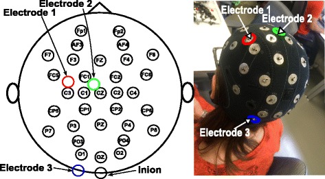 Fig. 1