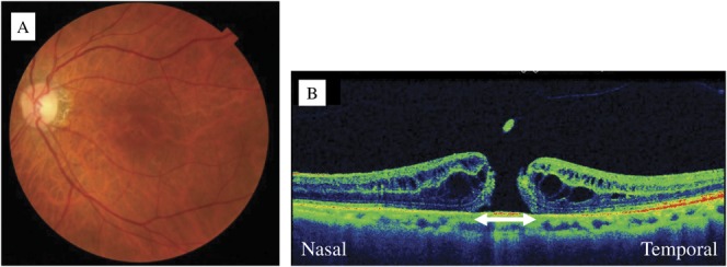 Fig. 1.