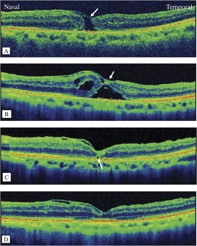 Fig. 3.