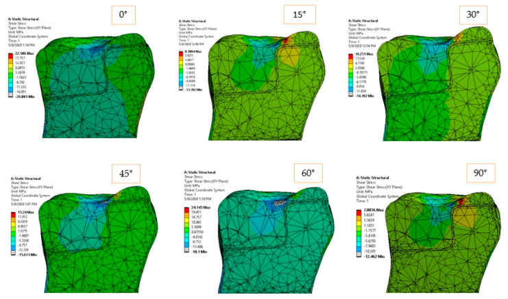 Figure 13