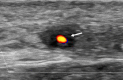 Fig. 1