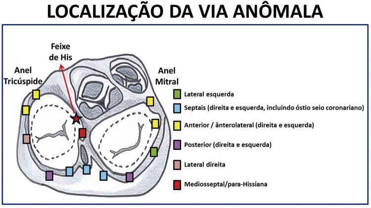 Figura 4.1