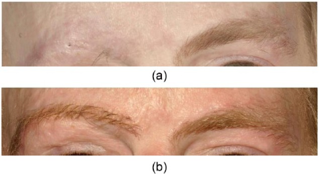Figure 12.