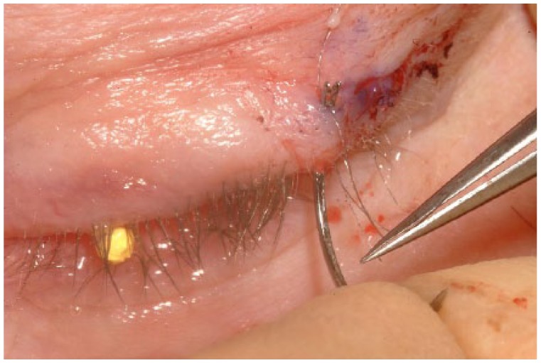 Figure 14.