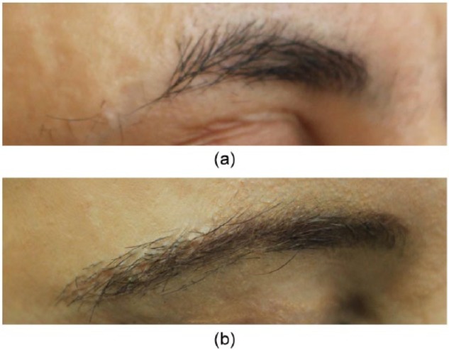 Figure 11.