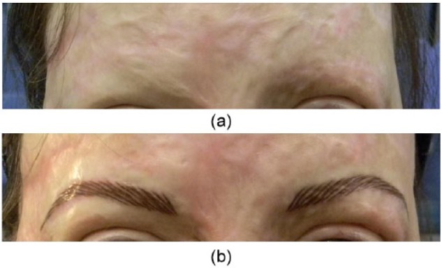 Figure 10.