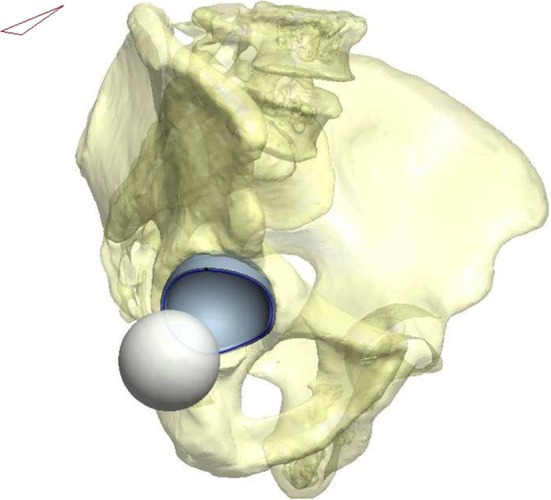 Fig. 1