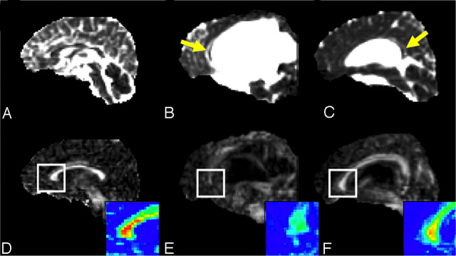 Fig 3.