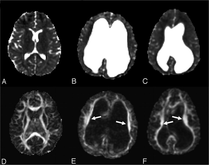 Fig 2.