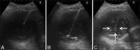 Figure 4 (A-C)