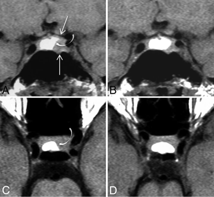 Fig 2.