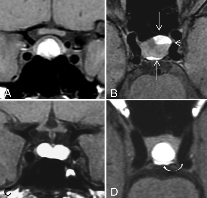 Fig 1.