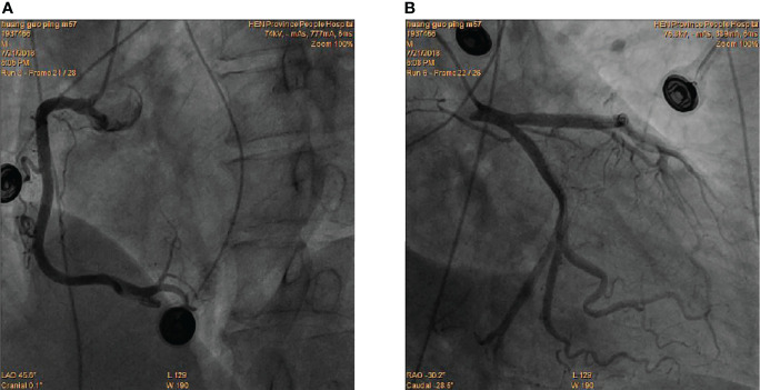 Figure 2