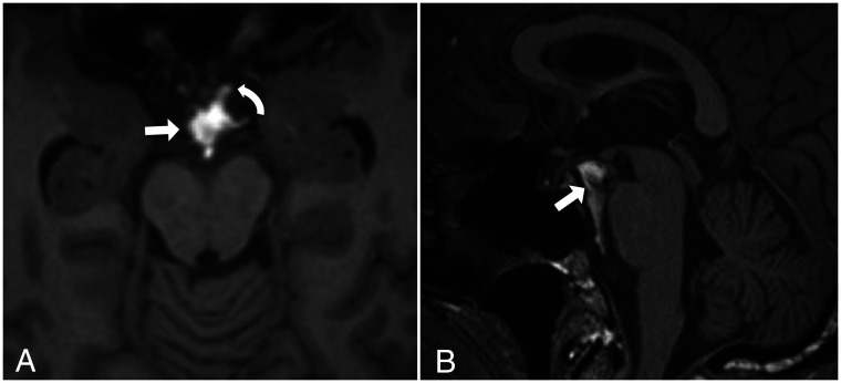 FIG 13.