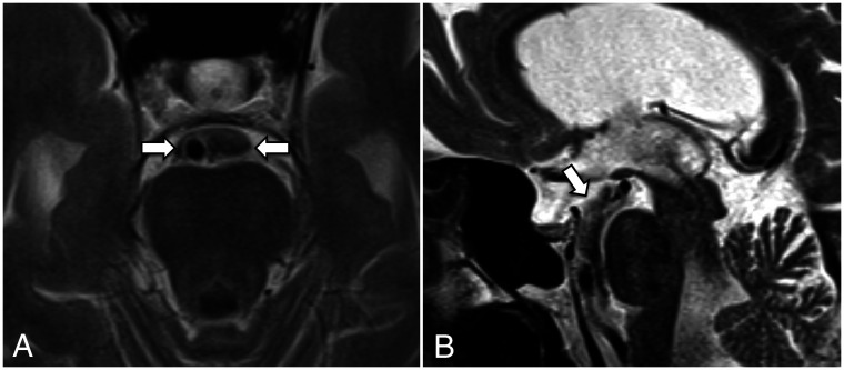 FIG 4.