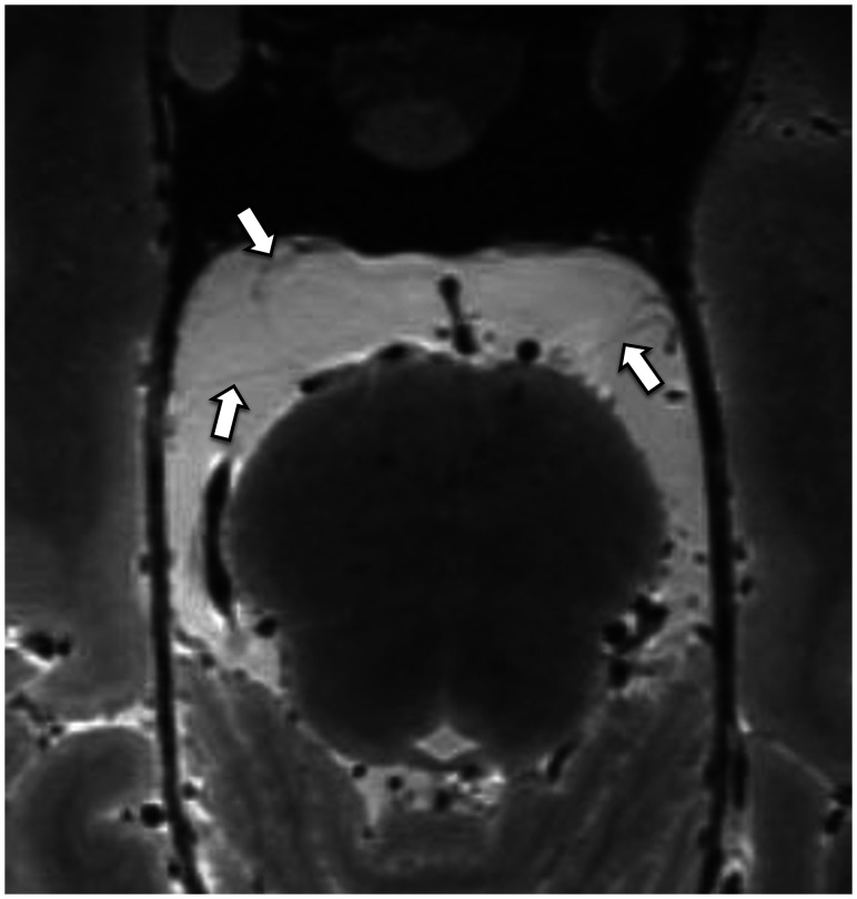 FIG 3.