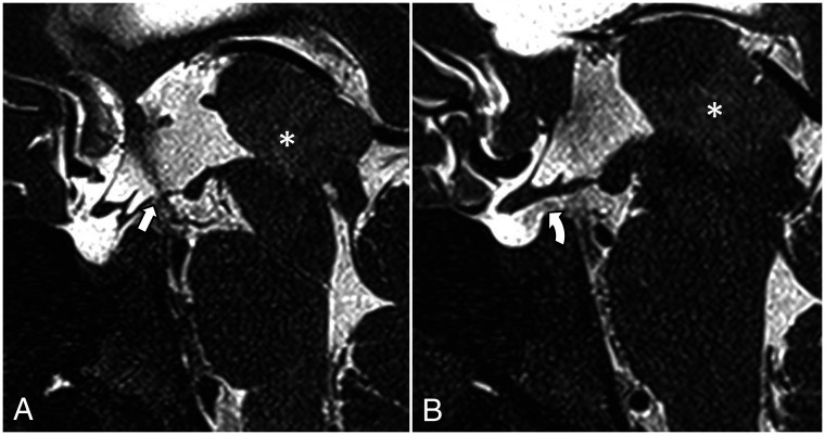 FIG 12.