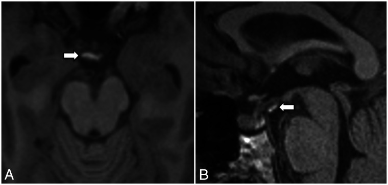 FIG 5.