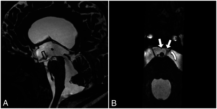 FIG 14.