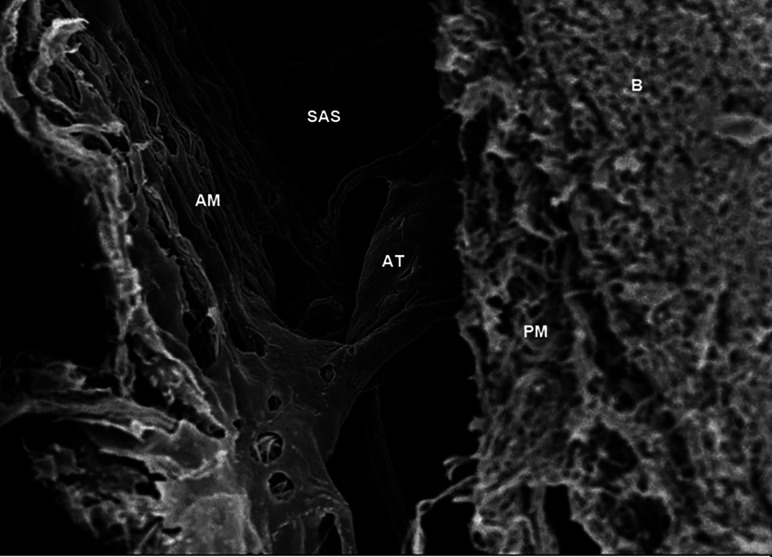 FIG 2.