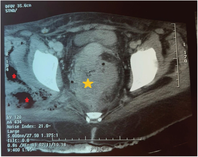 FIGURE 1