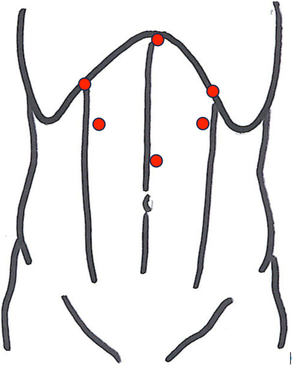 Fig. 1